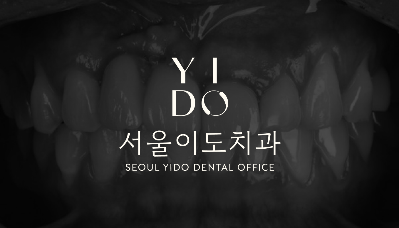 투명교정