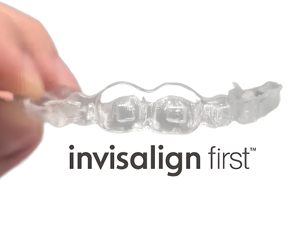 Headgear, facemasks, palatal expanders,