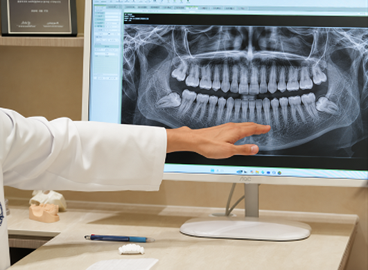 Confirming Wisdom Tooth Condition through Imaging